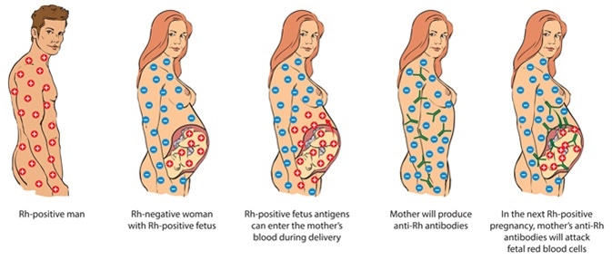 Rh-factor - Image Credit: NoPainNoGain / Shutterstock